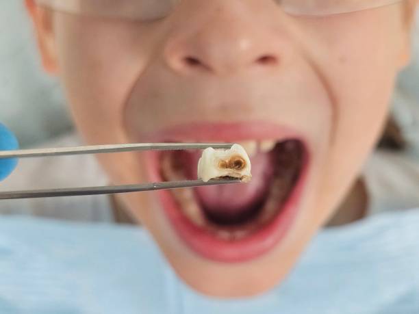 Best Emergency Gum Treatment in Chesaning, MI